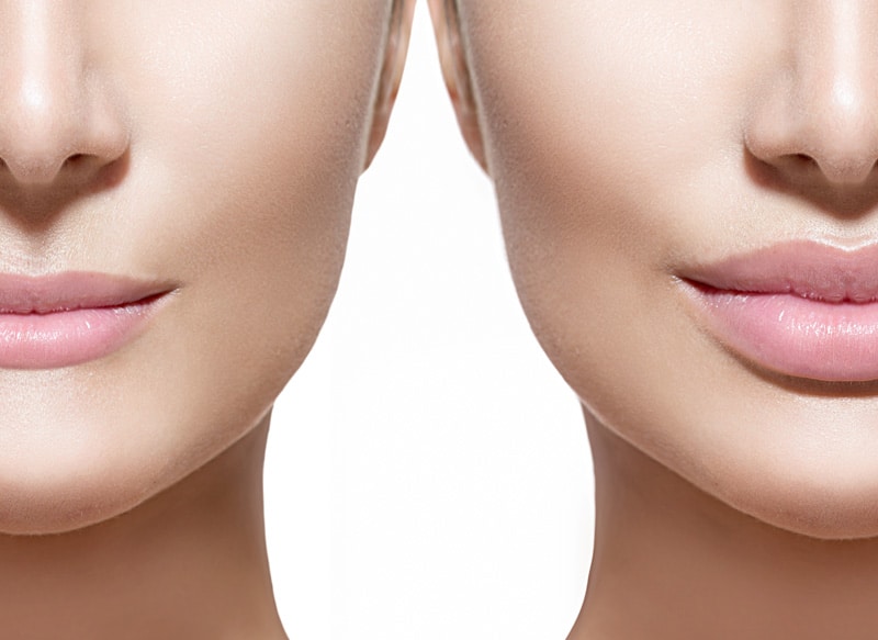 Facial Fillers in Chicago  Plastic Surgeons in Chicago, Il