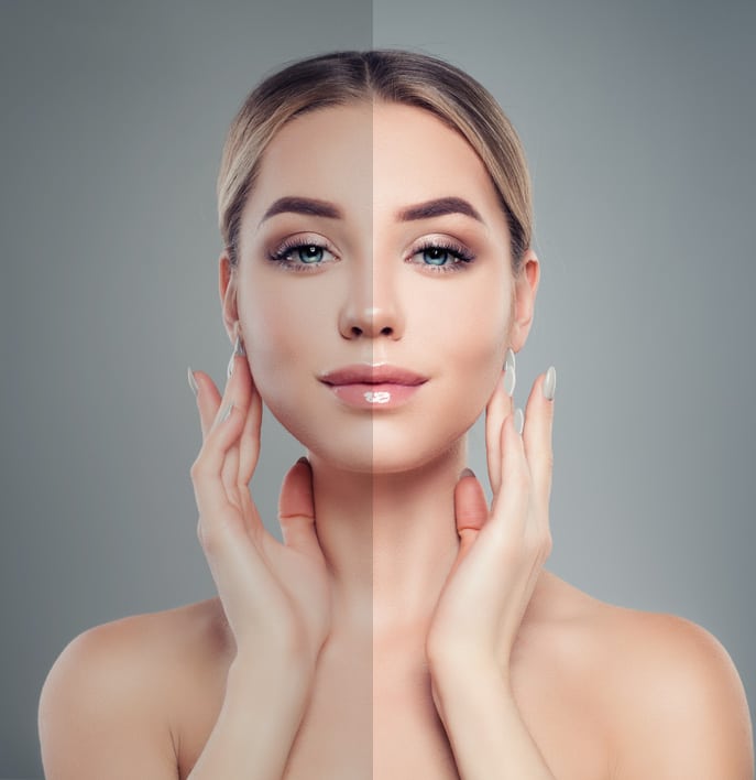 Chin And Cheek Augmentation