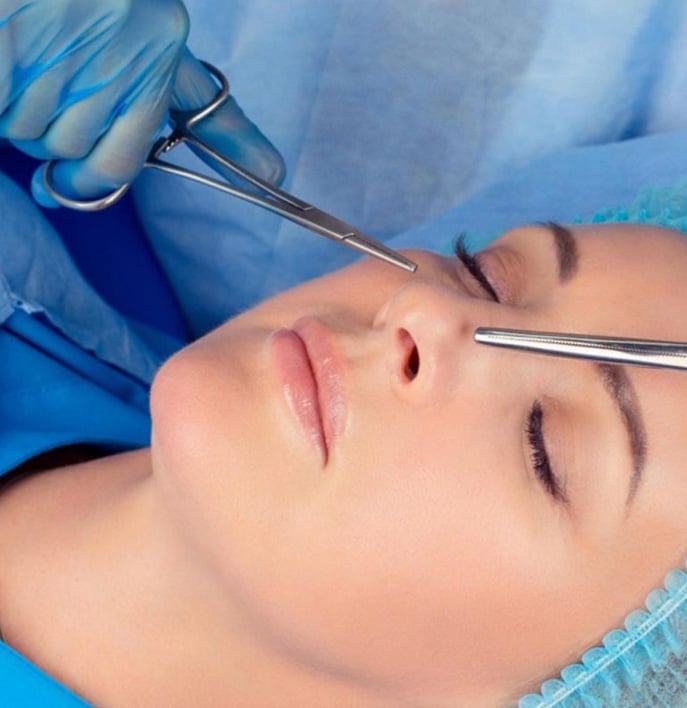 Rhinoplasty In Chicago