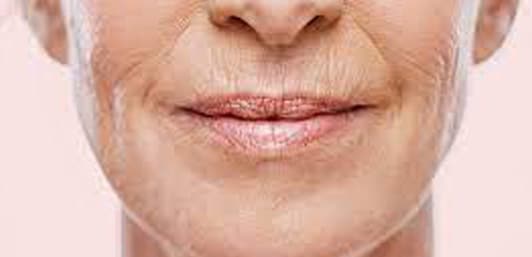 wrinkles-around-the-mouth-and-nose