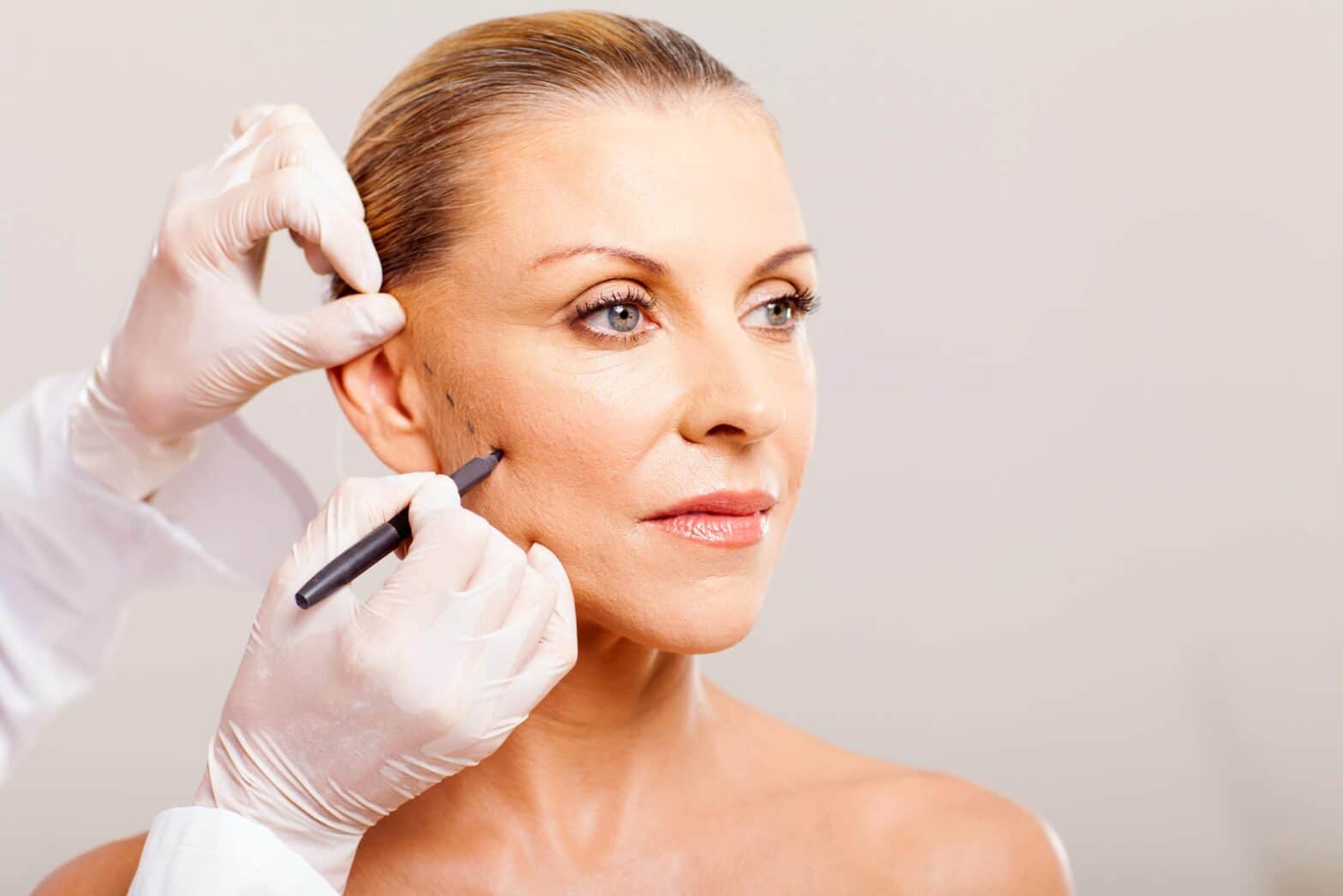 Facelift Surgery