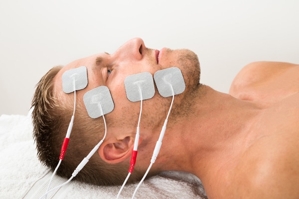 Electrical Stimulation