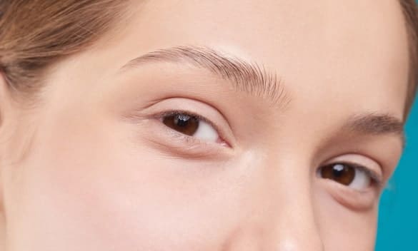 Upper Eyelid Surgery